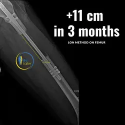 thumb_098503e2-d4d2-4728-a067-962f160cf630