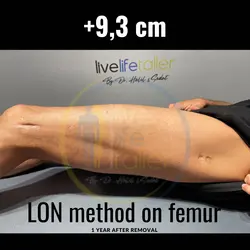 thumb_6b493d48-8eaf-49e1-8b8d-fbd6e932a2c4