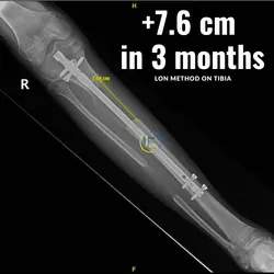 thumb_754d9461-a6dc-4351-8e27-c927e2d07399