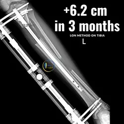 thumb_93ecacb1-6d8f-4ebe-b1c1-a7b00fbc93c3