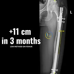 thumb_b7ebb1e9-7007-454e-8b53-73219f0dda7a