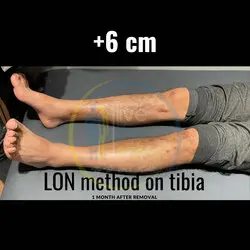 thumb_bf09b84f-7d48-4e4d-a13d-f41e10aab470