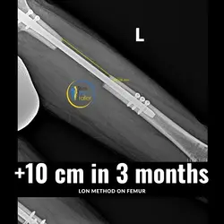 thumb_ca914bcd-5d8f-47ff-84d6-122879db0d58