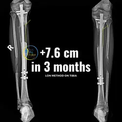 thumb_cce6a601-3d9d-4159-8379-b079d4c1da96