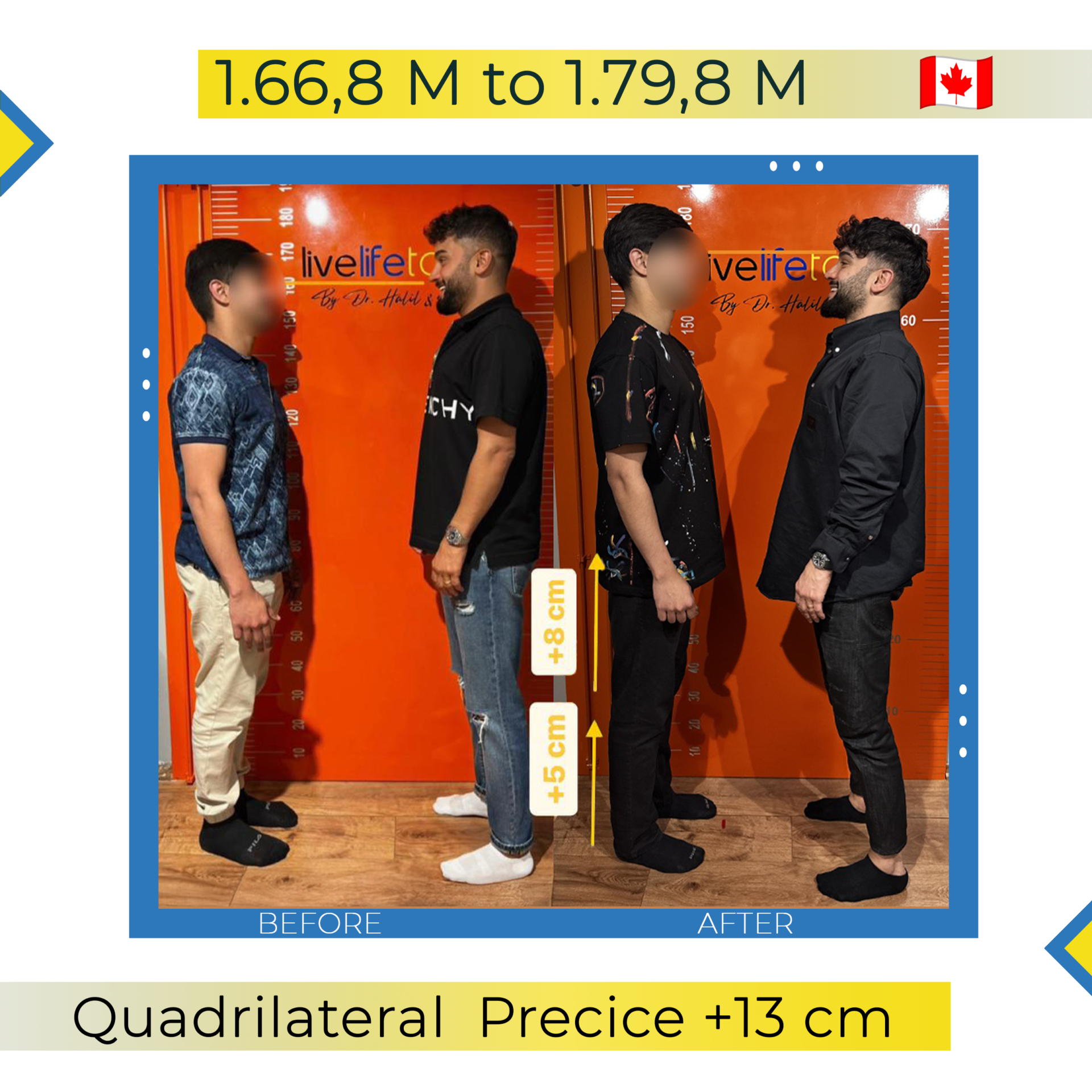 +13 cm Patient CA (2)